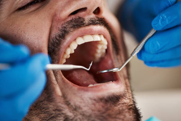 Best Affordable Emergency Dental Care  in Vandercook Lake, MI